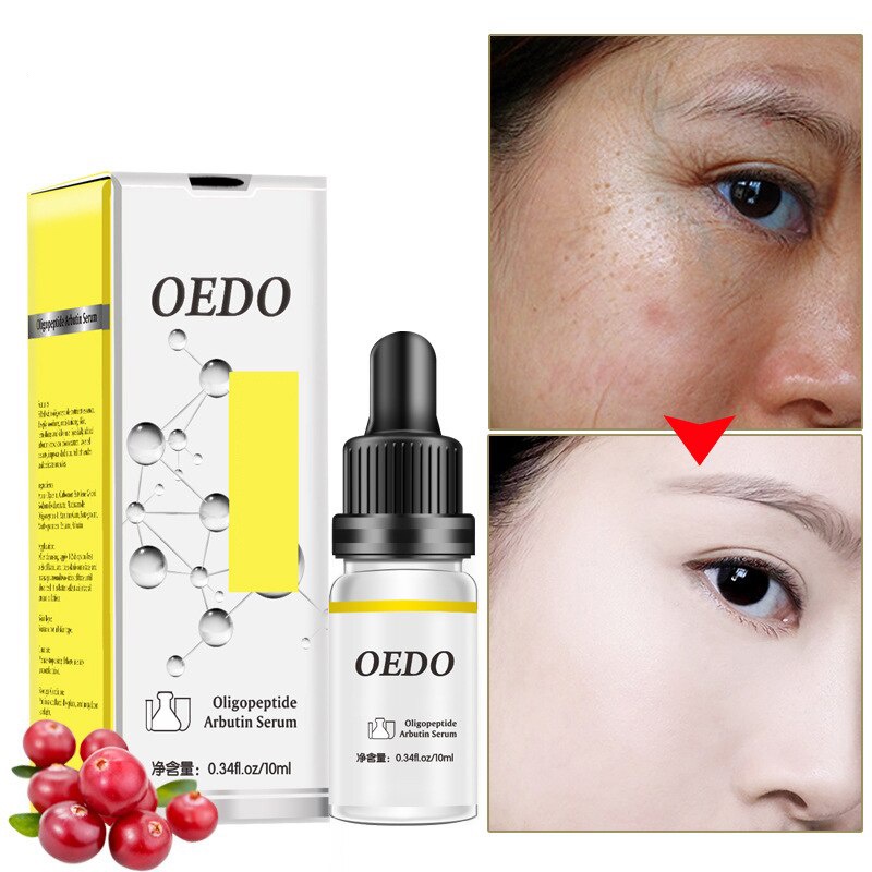 [Terbukti Alami] OEDO Oligopeptide Yeast Serum Anti-Aging Wajah Serum Kulit Anti Kerut Wajah