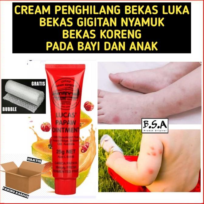 CREAM PENGHILANG BEKAS LUKA BEKAS GIGITAN NYAMUK PADA BAYI DAN ANAK