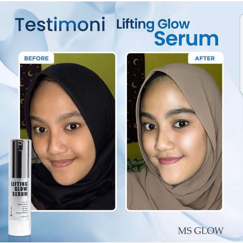 Lifting Whitening Serum 15 ml MS GLOW