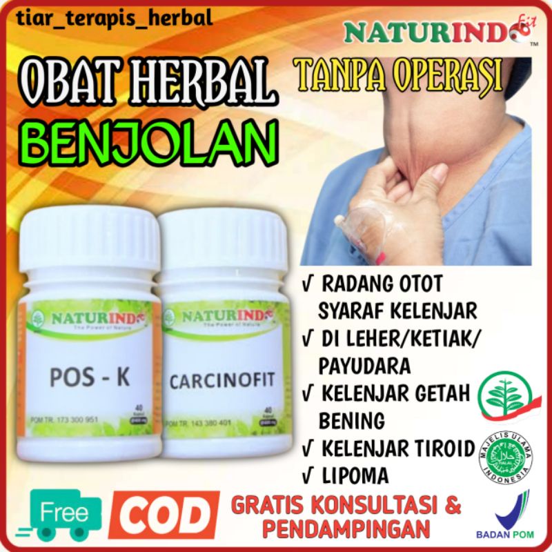 Jual Obat Herbal Benjolan Di Leher Kelenjar Getah Bening Lipoma Kanker ...