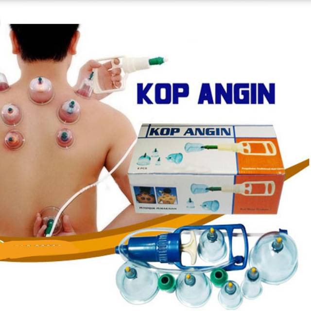 Kop angin - kop bekam