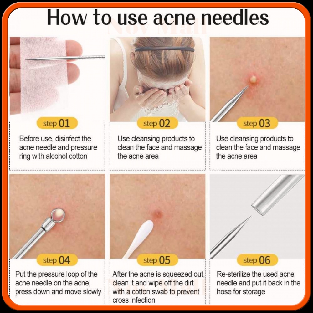 Alat Perlengkapan Komedo Jerawat Blackhead 7 PCS - BY930