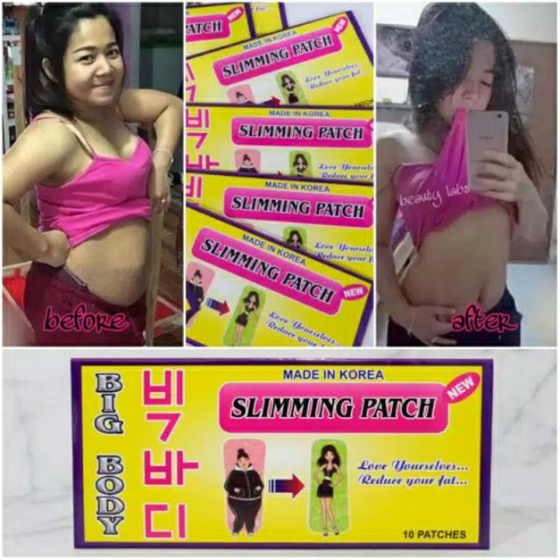 BIG BODY SLIMMING PATCH KOYO PELANGSING