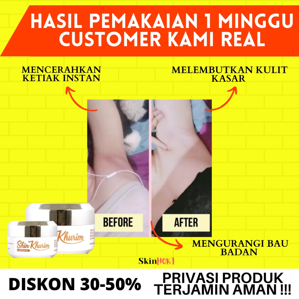 CREAM PEMUTIH KETIAK DAN SELANGKANGAN KRIM SHINKURIM 15gr PENCERAH LIPATAN TUBUH ORIGINAL BPOM