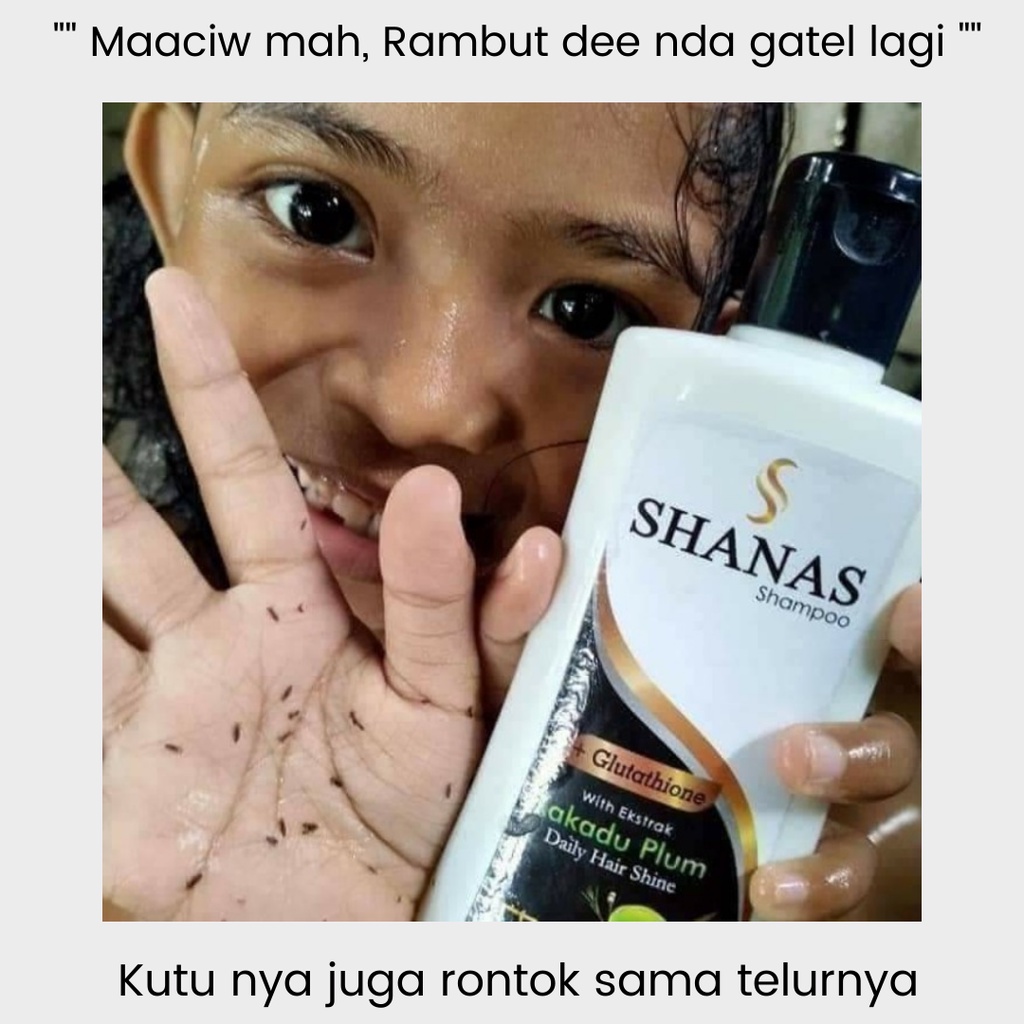 Shampo Shanas Nasa 175 Ml Original Pembersih Kutu Rambut Sampo Anti Kutu Rambut Anak Dewasa Shampoo Anti Ketombe Shampo Untuk Rambut Rontok Parah Paling Ampuh