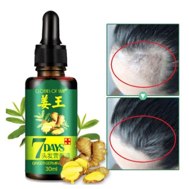 Serum Penumbuh Rambut Botak Ginger Germinal Oil 7 Days
