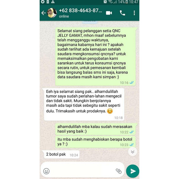 Obat Benjolan Di Tangan Benjolan Di Tangan Dekat Siku Benjolan Di Pergelangan Tangan Dekat Urat Nadi Shopee Indonesia