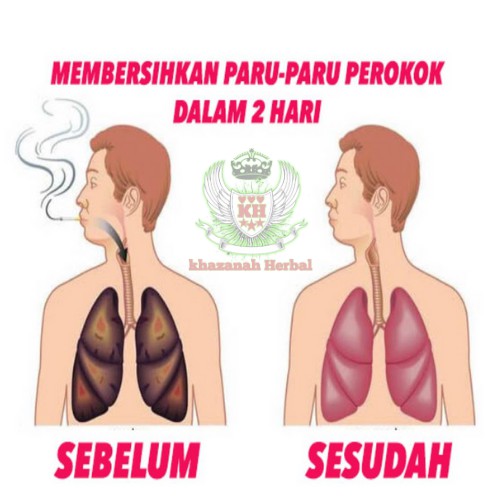 Obat herbal gurah paru paru2 suara sesak nafas batuk berdahak berlendir bronkitis TBC bron c fit-1