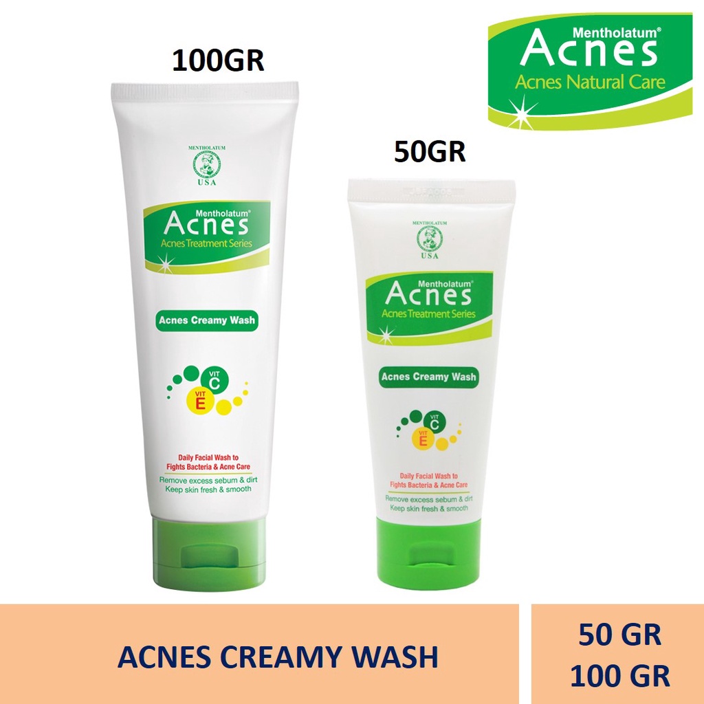 Jual Acnes Creamy Wash 100 gram 50 gram Facial Wash Kulit Berjerawat