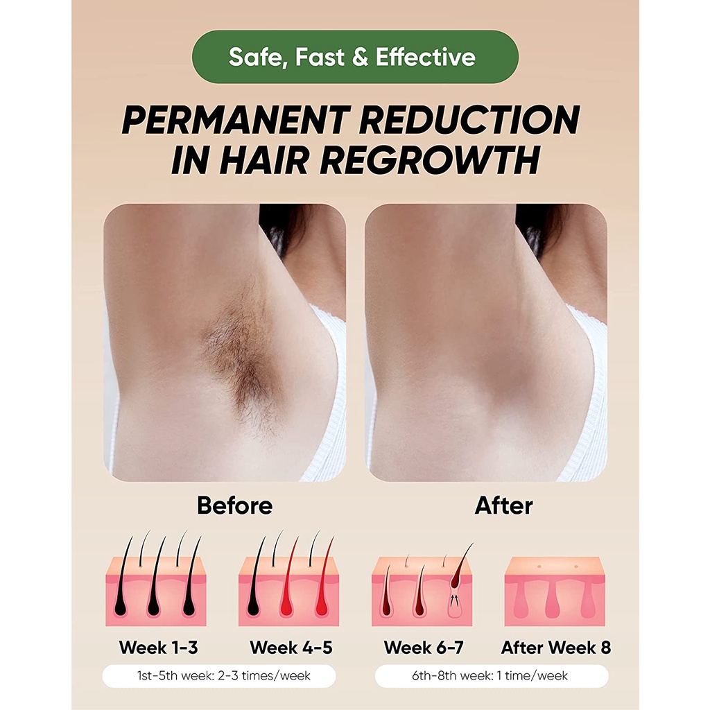 Laser Hair Removal Perontok Bulu Permanent Alat Penghilang Bulu TANPA SAKIT GARANSI / BOSIDIN D-1176 UK DESIGN GARANSI