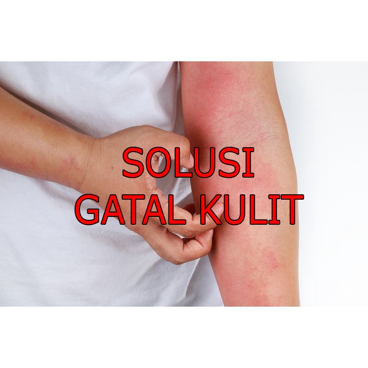 

HERBAL KAPSUL Gatal-gatal Kulit MEMBANDEL MENAHUN GATAL KULIT DALAM DAN LUAR/Obat herbal atasi tanpa operasi/Obat herbal asli/obat herbal tanpa bahan kimia/obat herbal bpom/obat herbal langsung pabrik