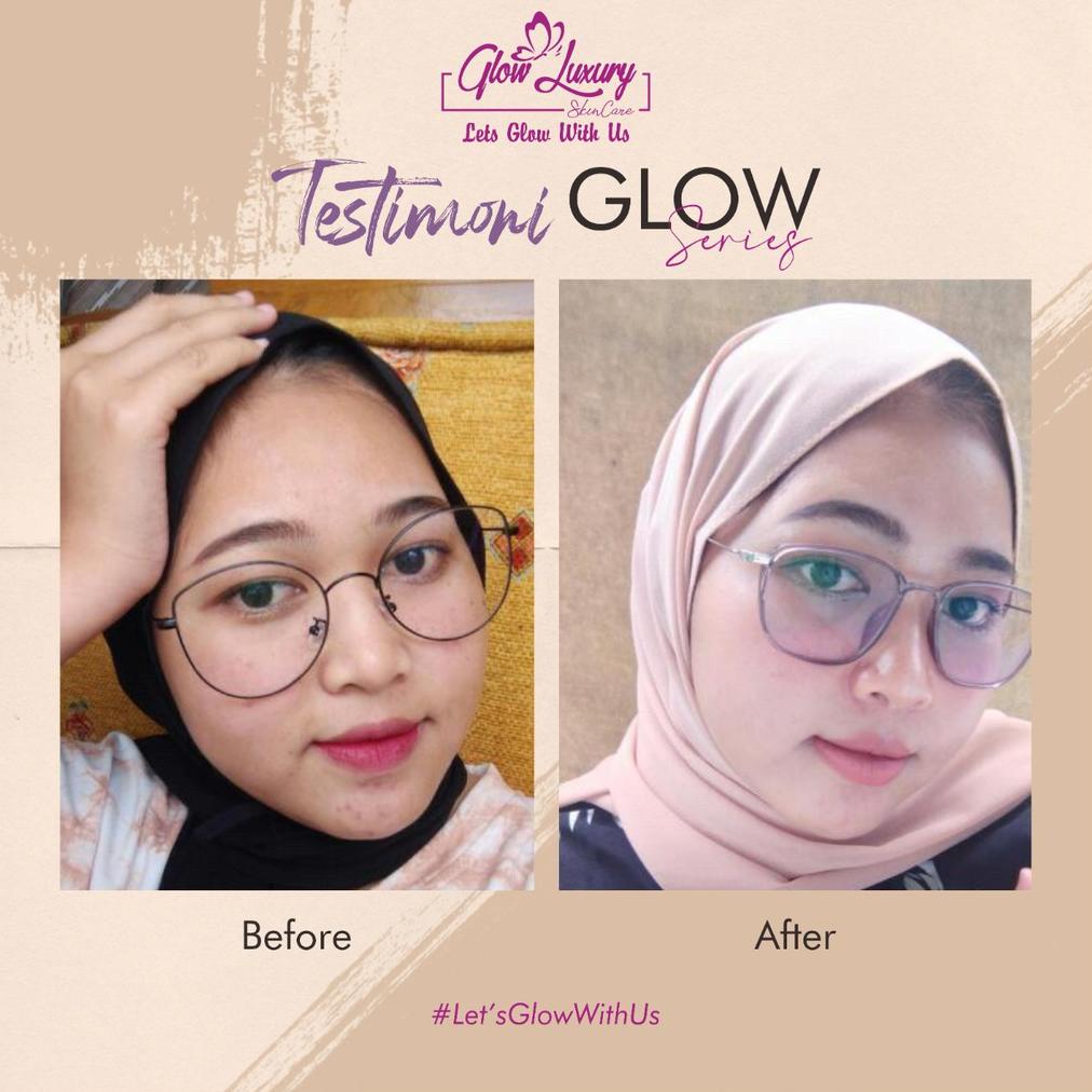 Paket Glow Luxury Skincare Bpom Series Glow