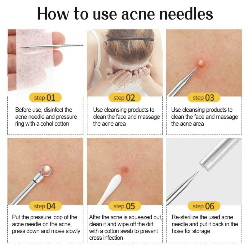 Alat Perlengkapan Komedo Jerawat Acne Blackhead Face Skin Care Feita 7 Pcs Pt-8