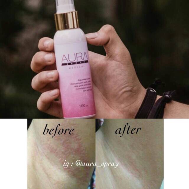 AURA SPRAY MEDICAL