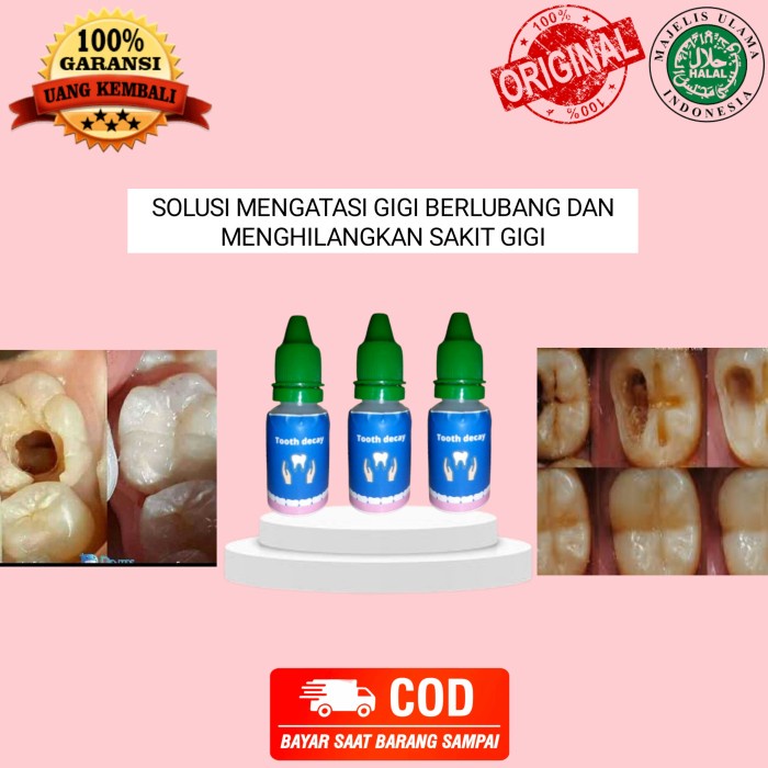 Whitening Tooth Decay Ori Penumbuh Gigi Dan Hilang Sakit Gigi (Free Handsfree)