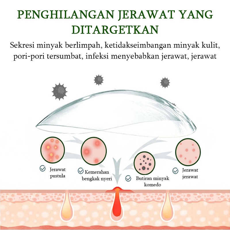 Serum Cream penghilang jerawat Gel Perawatan jerawat Cream untuk jerawat 30g Memperbaiki Menenangkan dan memperbaiki jerawat Kulit berjerawat Kulit halus Lembut dan tembus pandang