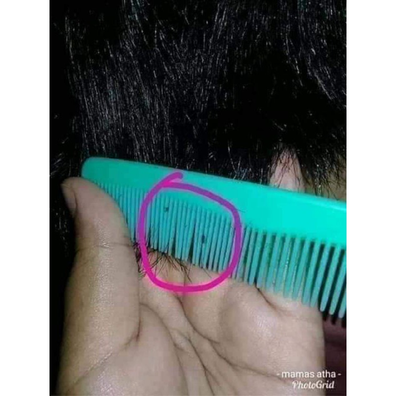 OBAT PEMBASMI KUTU/OBAT pelembat rambut/obat ketombe dari minyak kelapa asli sr12