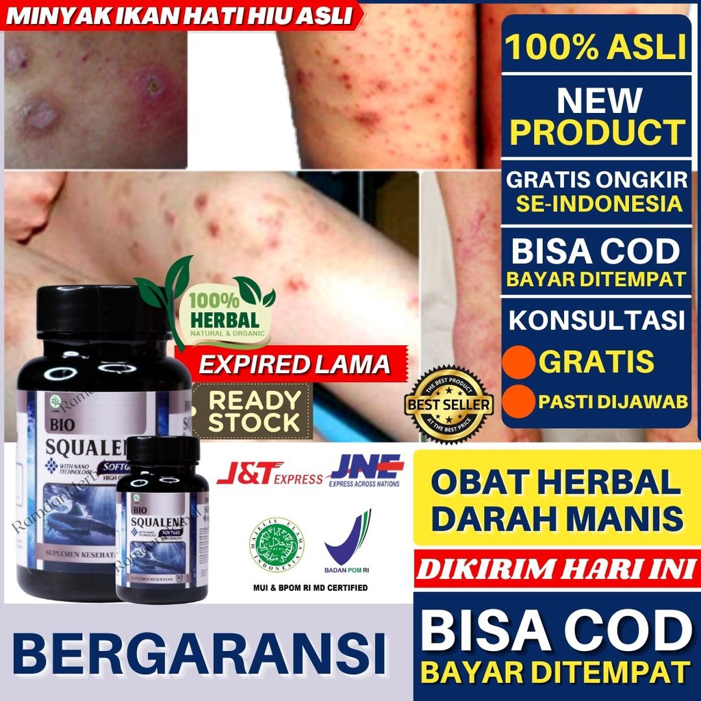 Jual Squalene Obat Darah Manis Obat Prurigo Obat Kulit Gatal Gatal