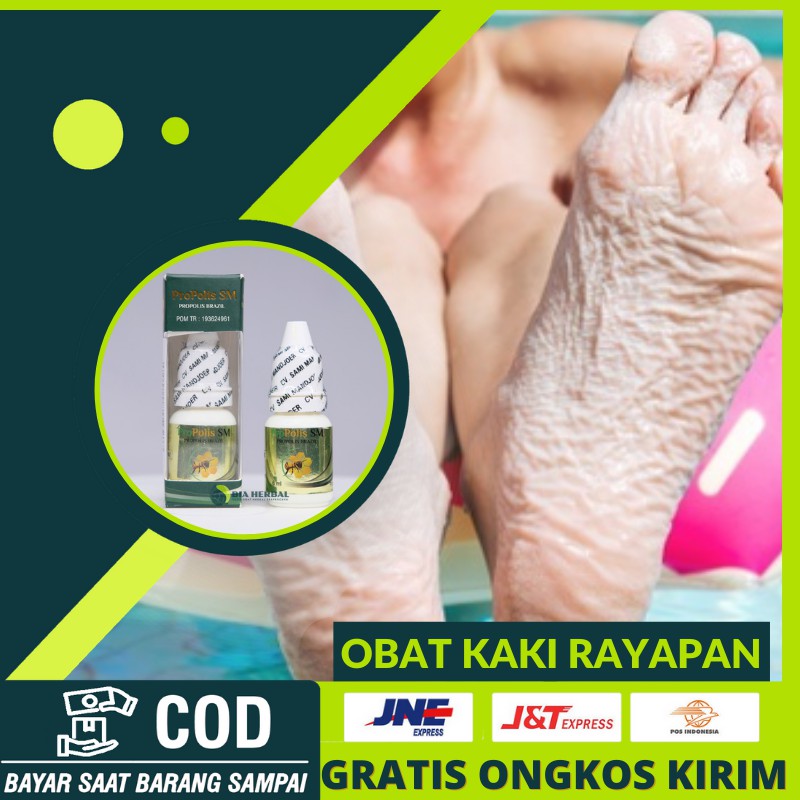 Obat Kaki Rayapan Dan Bau Obat Pitted Keratolysis Obat Penghilang Telapak Kaki Rayapan Berlubang Shopee Indonesia