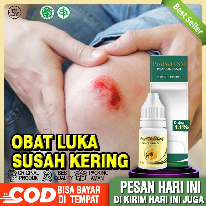 Obat Luka Susah Kering, Pengering Luka, Luka Agar Cepat Kering, Luka Basah, Luka Bernanah, Luka Kore