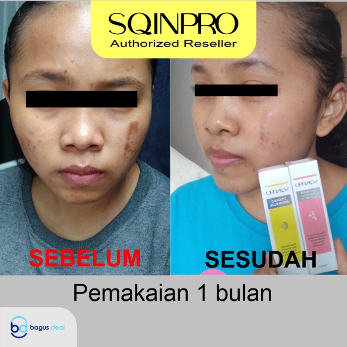 SQINPRO Serum Niacinamide 12% Plus Zinc 1% (10ml) | Anti Aging | BPOM