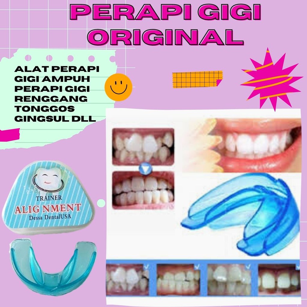 Perapi Gigi Trainer Alignment Behel Ajaib Gigi renggang Tonggos