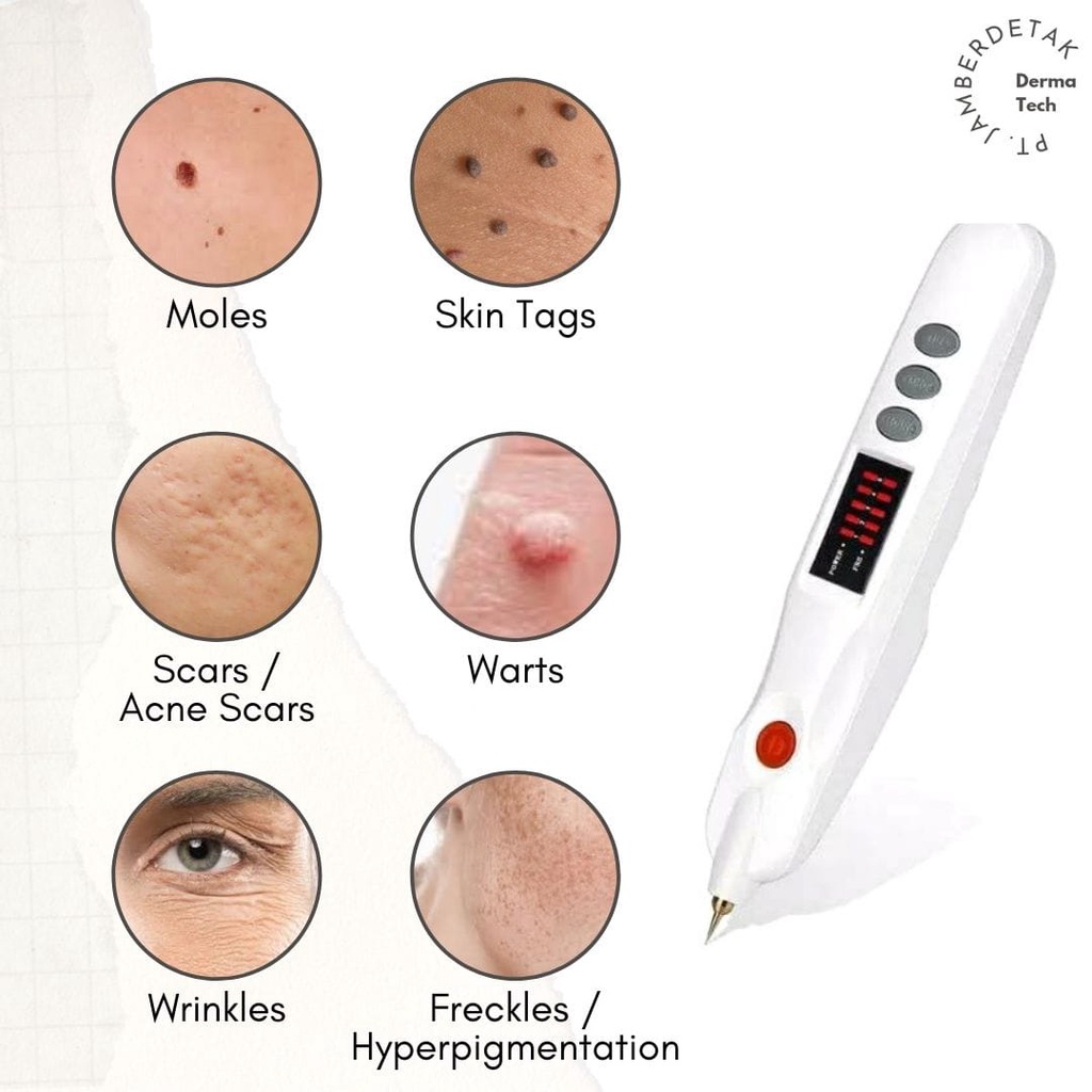 Beauty monster plasma pen alat laser penghilang flek kutil tai lalat melasma