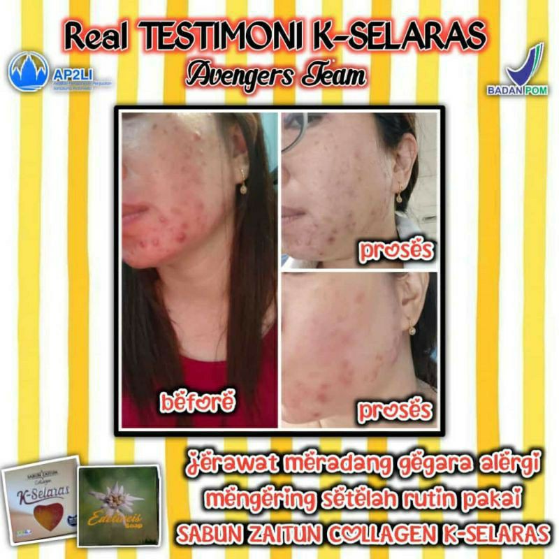 

(BISA COD) Sabun zaitun selaras