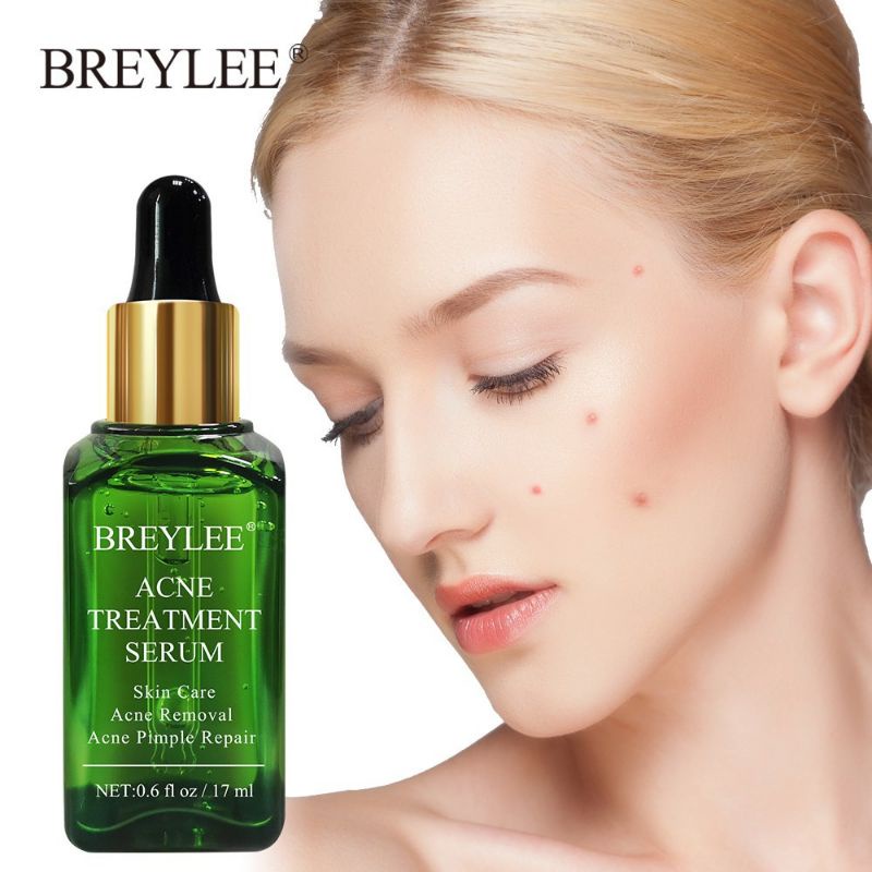 [17ml] Breylee Acne Treatment Serum