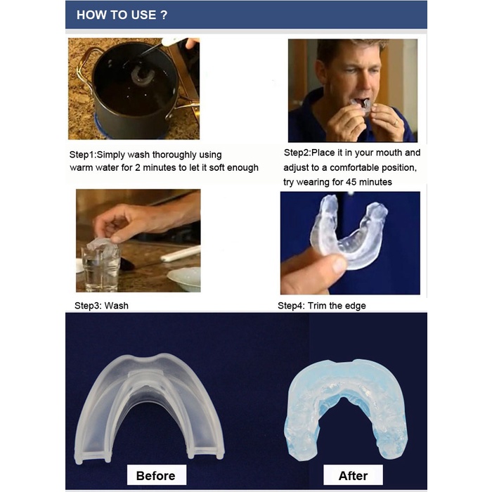 Alat Anti Ngorok Penghilang Dengkur Stop Snoring Solution Mouthpiece