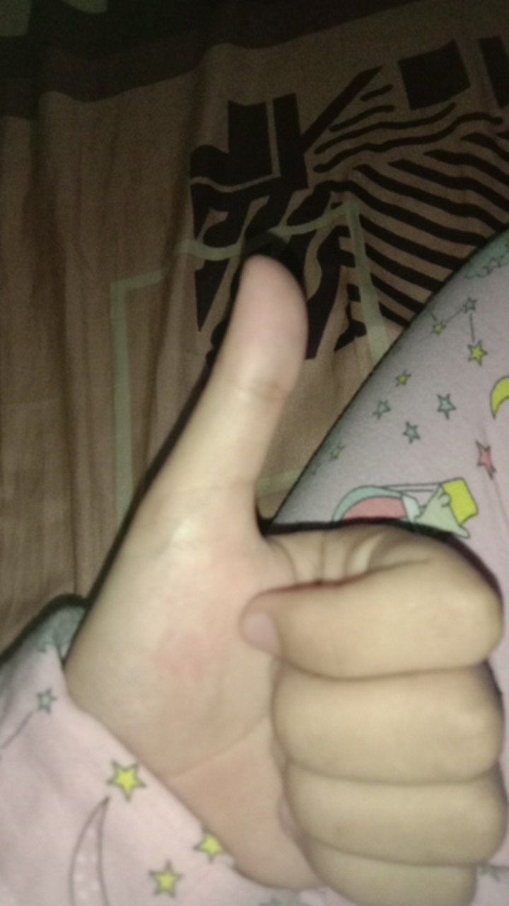 Centong Nasi Ajaib, Centong Nasi Buka Tutup Otomatis, Centong Nasi Anti Lengket