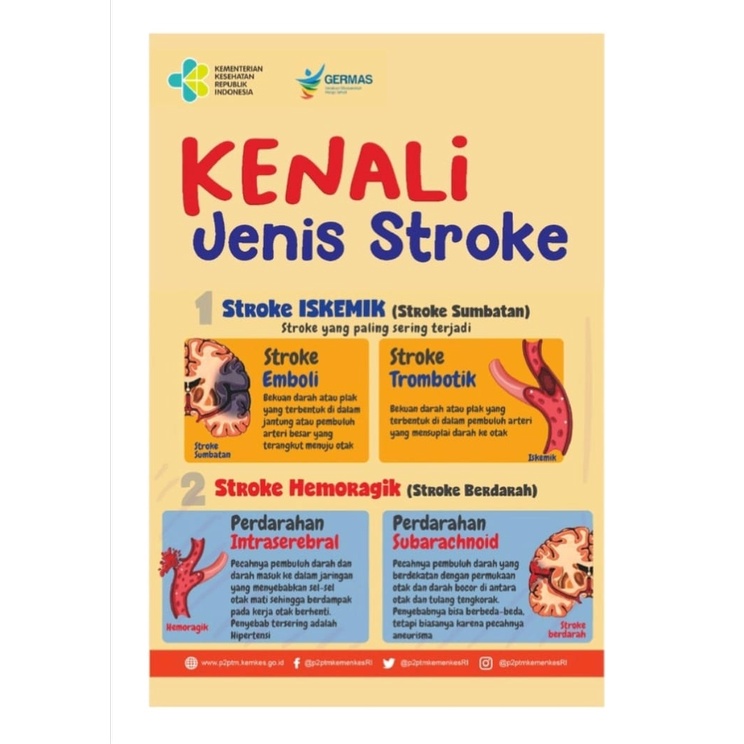 

Poster Kesehatan Kenali Jenis Stroke