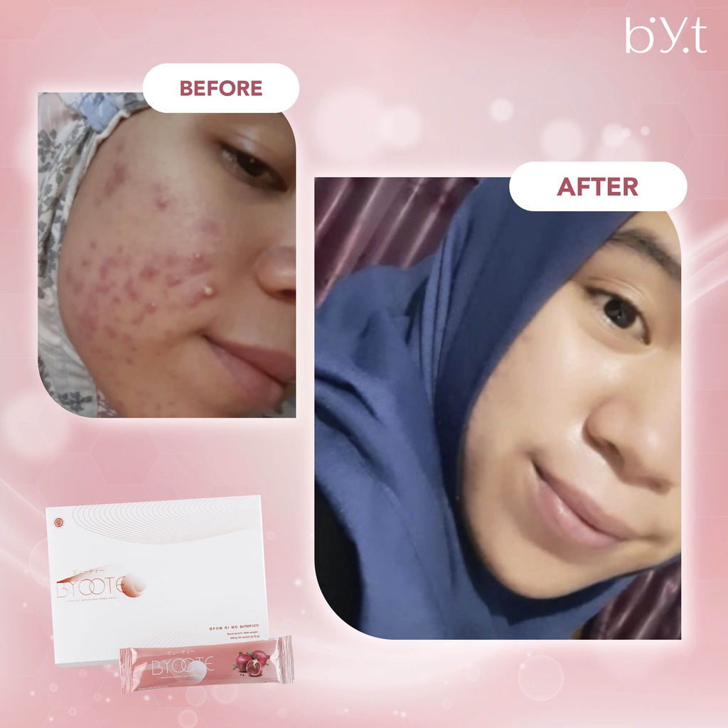 Byoote Collagen 1 Box 16 Sachet - Minuman Colagen Kolagen Drink Murah - Halal BPOM Asli Original Official