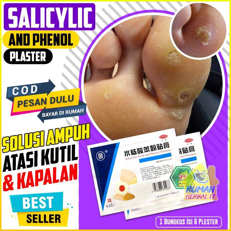 [BAYAR DI TEMPAT] Salicylic And Phenol Plasters Original – Plester Kutil dan Mata Ikan
