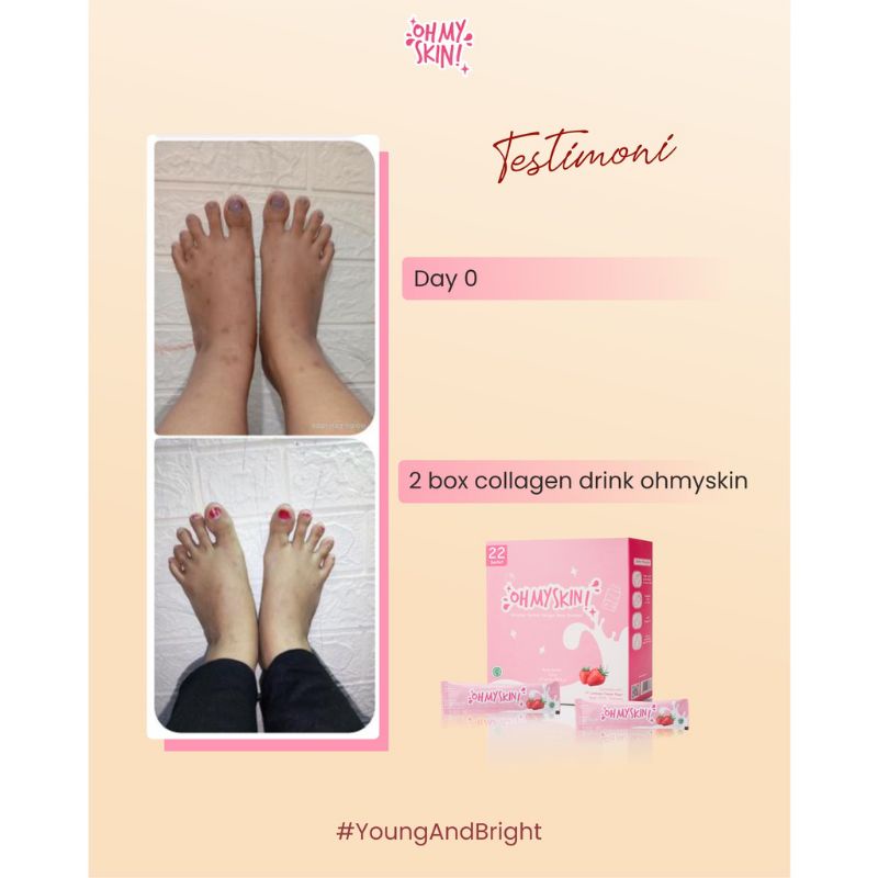 [READY STOCK] COLLAGEN DRINK OHMYSKIN! ISI 10 | 22 SACHET