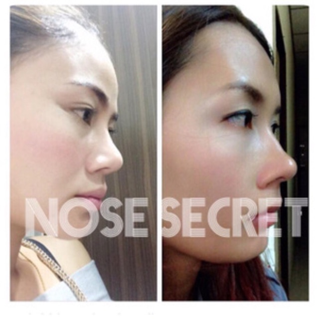 Nose secret 3D / pemancing hidung Instant tanpa operasi