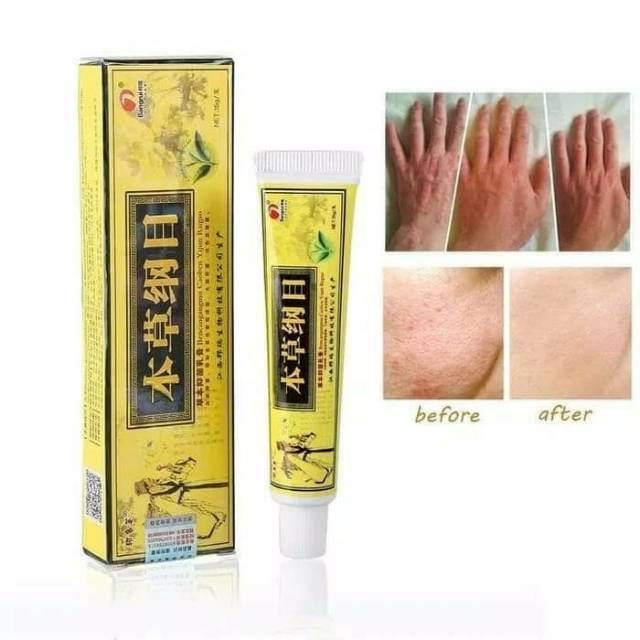 Ready Salep Anti Bakteri Anti Gatal Krim Psoriasis Dermatis Eksim