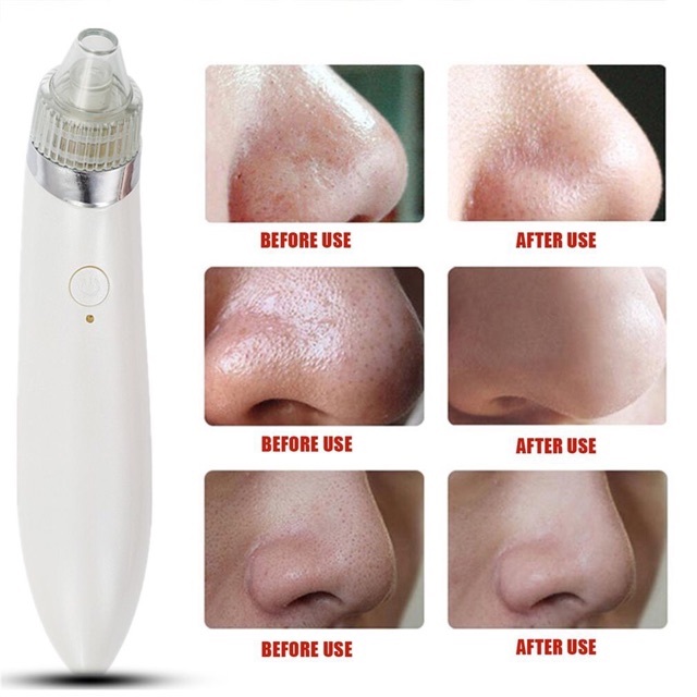 Alat facial kecantikan wajah Portable homeuse vacum comedo and diamond dermabrasi pengangkat komedo