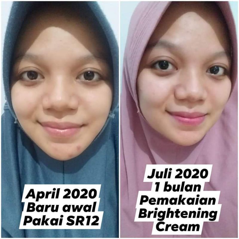 BRIGHTENING CREAM SR12(siang - malam) / KRIM PENCERAH WAJAH / KUSAM / FLEK HITAM / KRIM HERBAL BPOM