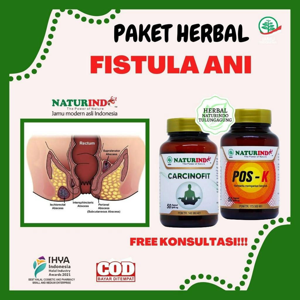 Obat Fistula Ani Nyeri Anus Herbal Ampuh Obat Bisul Ampuh Obat Bisul Herbal Vistula Fistula Radang A