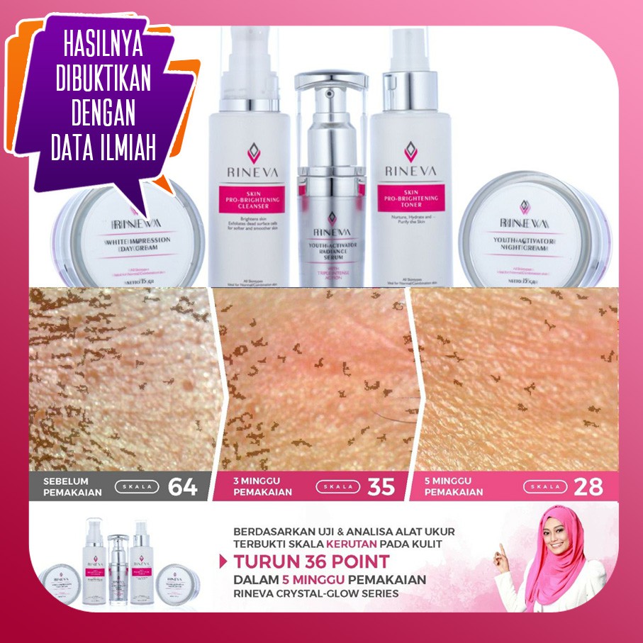 Herbal Perawatan Wajah Skin Care Halal Rineva Bebas Bahan Berbahaya Shopee Indonesia