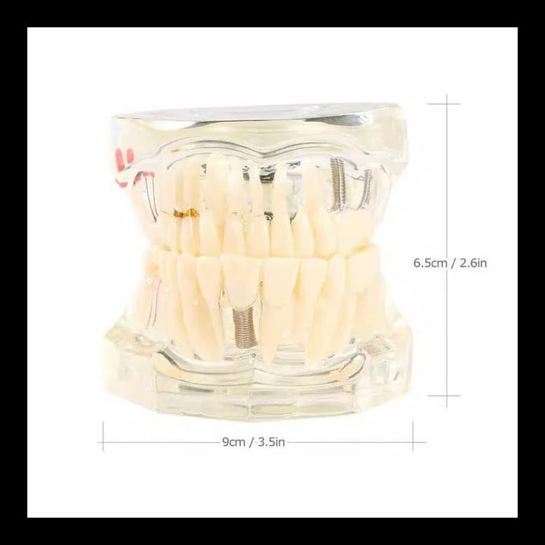 UPDATE STUDY MODEL GIGI TRANSPARAN / PHANTOM GIGI LENGKAP BEHEL MURAH AL6