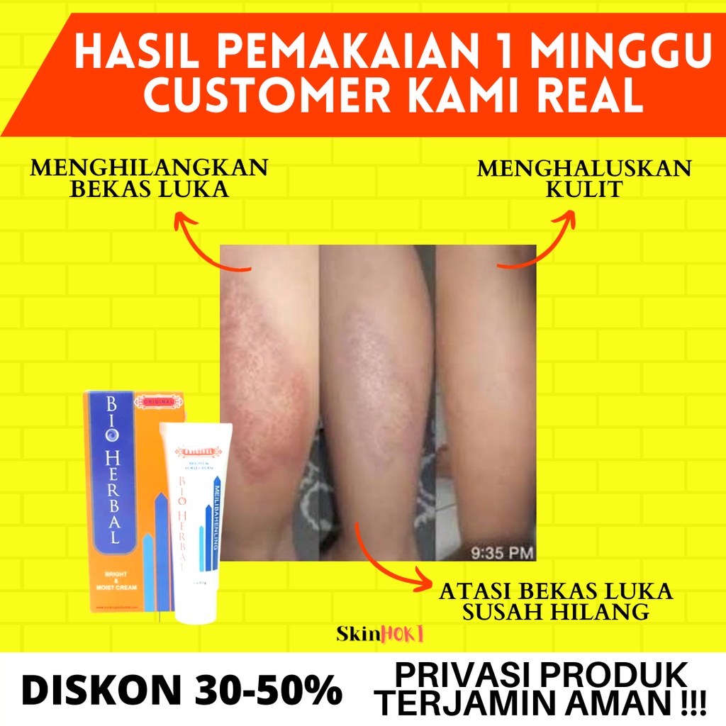 PENGHILANG BEKAS LUKA PENGHILANG KELOID BIO HERBAL MEILBAHENLING 60ML salep luka bakar PENYAMAR FLEK HITAM ORIGINAL BPOM