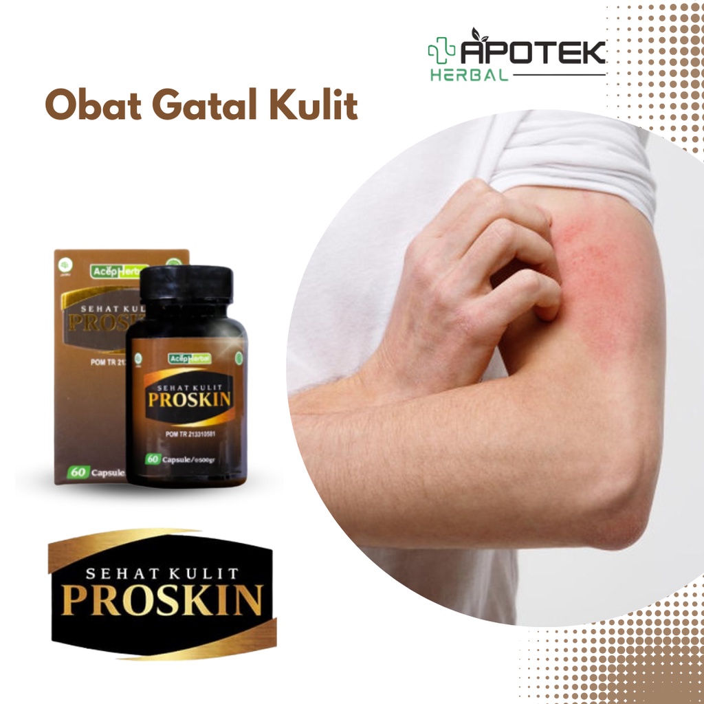 Obat Gatal Pada Kulit, Obat Gatal Jamur Kulit, Obat Gatal Kurap, Obat Gatal Kutu Air, Obat Gatal Eks