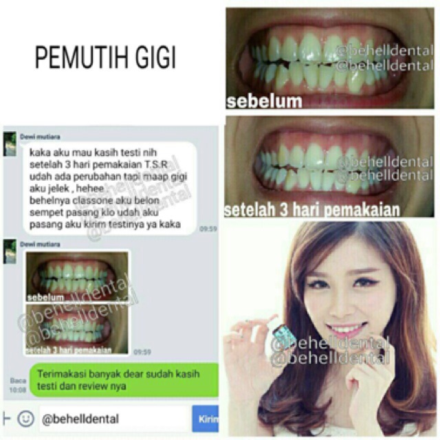 TSR ORI | PEMUTIH GIGI AMPUH PENGHILANG BAU MULUT PELUNAK KARANG GIGI BLEACHING WHITENING TEETH