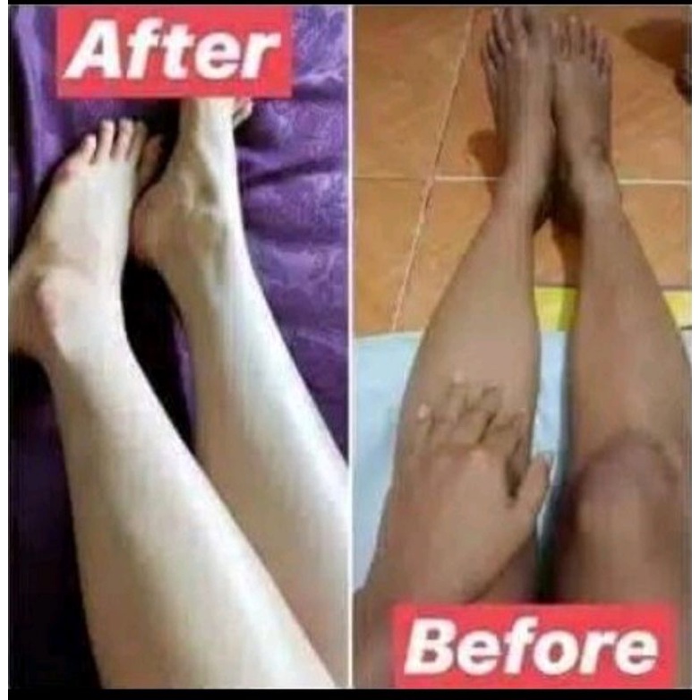 lotion hb ungu platinum dosis tinggi 5kli lebih cepat memutihkan