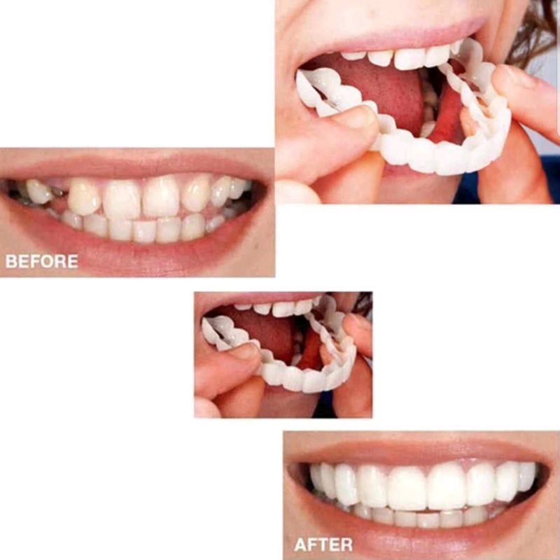 Snap On Smile Gigi Palsu 1 Set Atas Bawah 100% Original / Gigi Palsu Silikon / Gigi Palsu Instan / Snap On Smile Veneers / Gigi Palsu Lepas Pasang / Gigi Palsu Sepasang