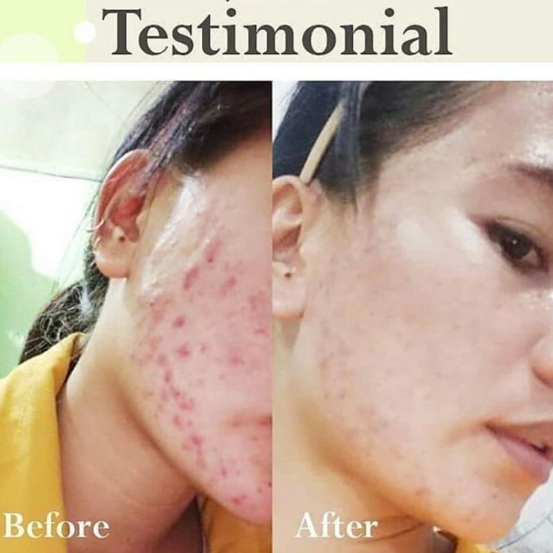 PAKET WAJAH/SKINCARE/PERAWATAN WAJAH PREMIUM WHITENING BPOM PRADISKIN GLOW-6