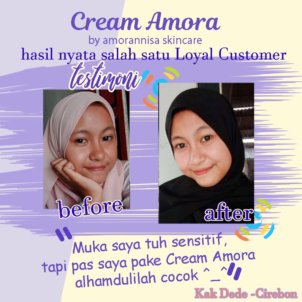 Amora Skincare Paket Pemutih Wajah Glowing Acne Kusam ASC-7