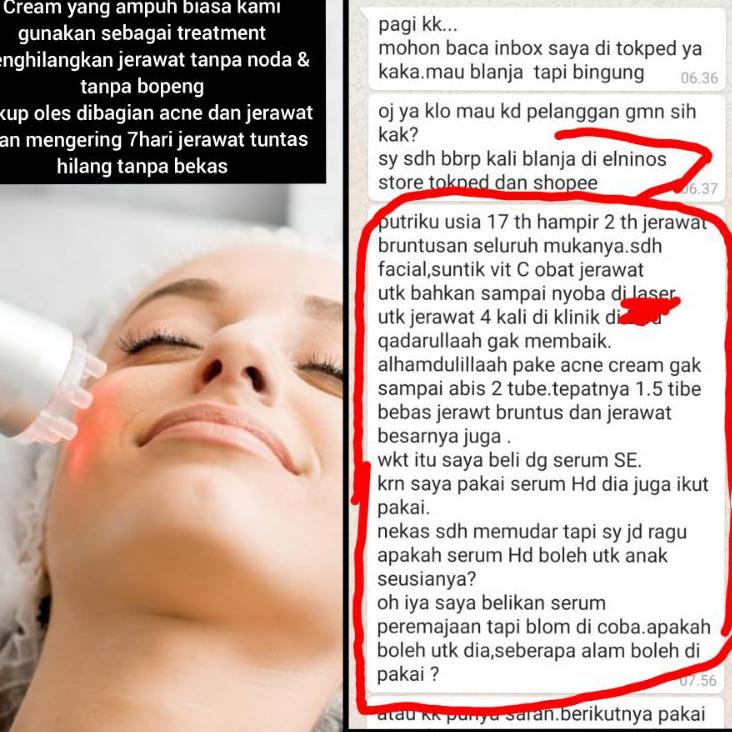 ♬ ELNINO'S ANTI-JERAWAT 125% PATEN RACIK BEAUTY CLINIC ➹